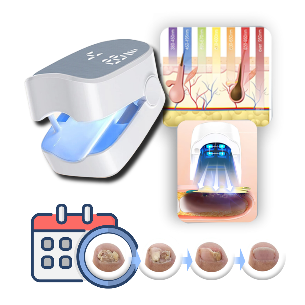 Nail Care Laser Device | Dual Laser Modes &amp; Blue Light | Rechargeable Portable Nail Care Tool