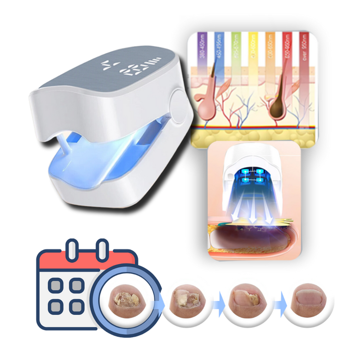Nail Care Laser Device | Dual Laser Modes &amp; Blue Light | Rechargeable Portable Nail Care Tool