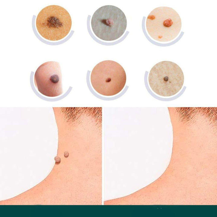 Skin Tag Patches | Hydrocolloid Adhesive Patches with Tea Tree Oil | Discreet Skin Care Patches | 120 Count