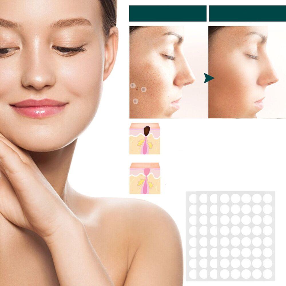 Skin Tag Patches | Hydrocolloid Adhesive Patches with Tea Tree Oil | Discreet Skin Care Patches | 120 Count