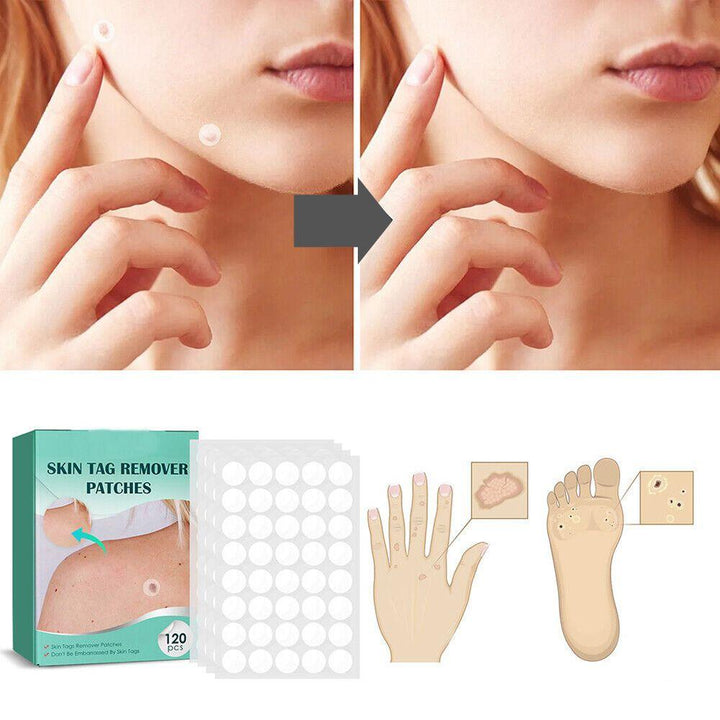 Skin Tag Patches | Hydrocolloid Adhesive Patches with Tea Tree Oil | Discreet Skin Care Patches | 120 Count