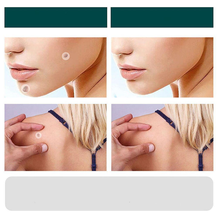 Skin Tag Patches | Hydrocolloid Adhesive Patches with Tea Tree Oil | Discreet Skin Care Patches | 120 Count